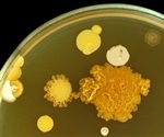 Scientists find link between chronic pain and gut microbiome
