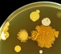 New technology can track beneficial bacteria after fecal microbiota transplants