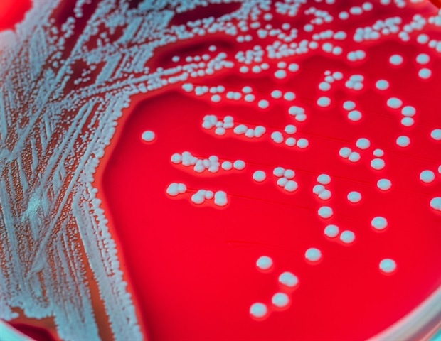 New biofilm discovery may pave way to undermining antibiotic-resistant Pseudomonas