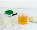 Is partial nephrectomy oncologically safe for tumors greater than 4cm?