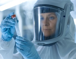 Giant amoeba-infecting viruses offer new clues to the origin of eukaryotic life