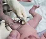 Delaying umbilical cord clamping after birth benefits newborn babies