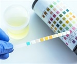 Breath or urine analysis with optical gas sensors may detect cancer, diabetes