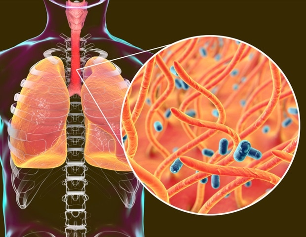 Maternal pertussis vaccination delivers early immune protection to newborns