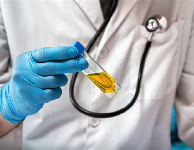 Beckman Coulter Diagnostics launches fully automated urinalysis system to meet rising testing volumes