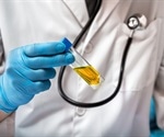 Urinary Tract Infection Diagnosis