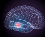 EPR Spectroscopy is Expanding our Knowledge of Parkinson's Disease