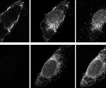How SARS-CoV-2's spike protein highjacks the host cell trafficking machinery