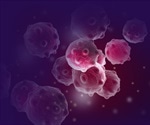 High Throughput Identification and Quantification of Breast Cancer With NMR-Based Metabolomics