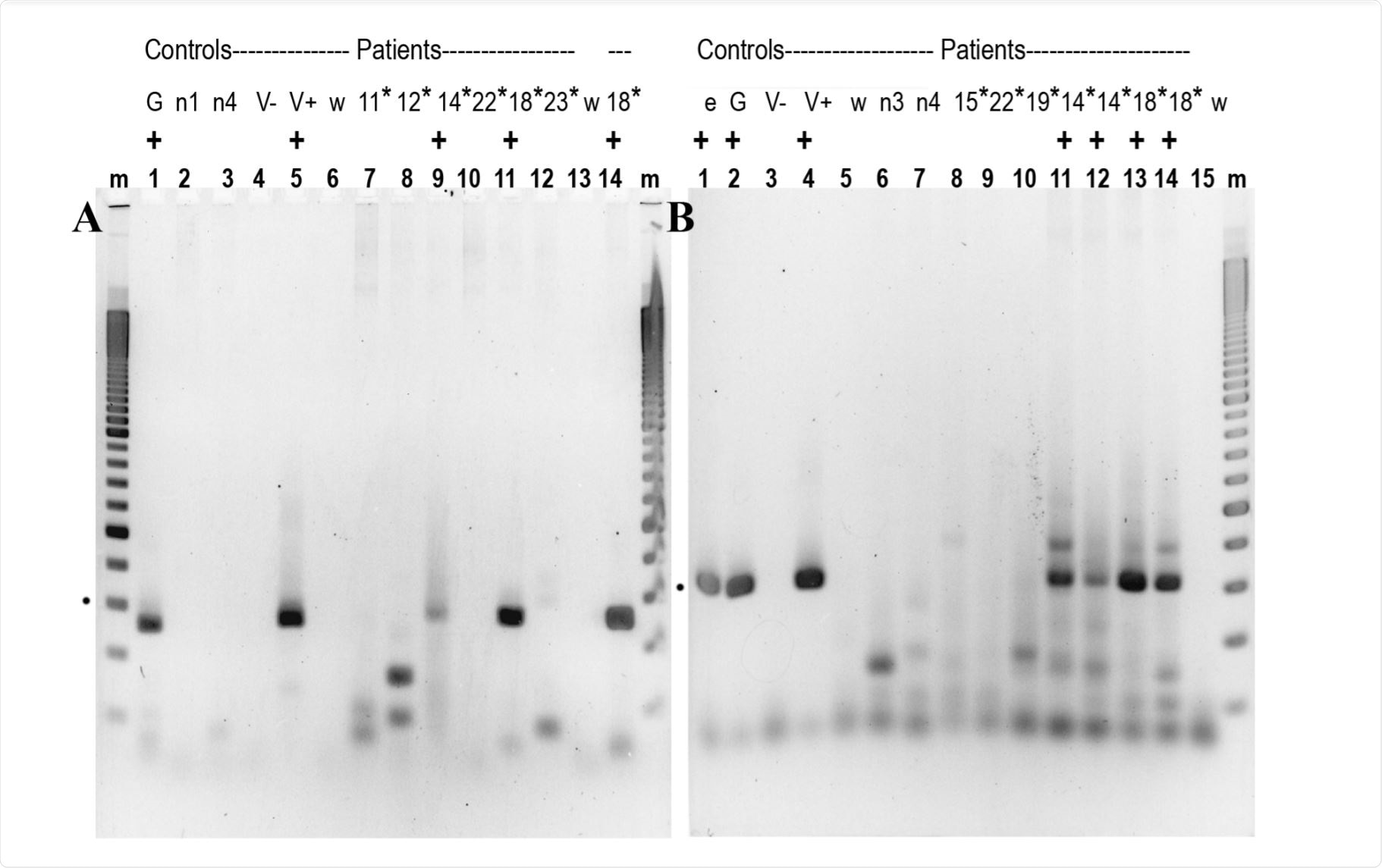 A 2.5% agarose gel showing RT/qPCR products A 2.5% agarose gel showing RT/qPCR products