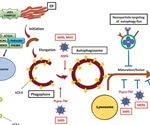 New insight into role of autophagy in controlling SARS-CoV-2 infection