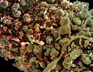 French scientists suggest nicotinic agonists could treat COVID-19