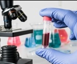 Study of nearly 10,000 women explores feasibility and safety of multi-cancer blood test