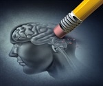 Blood Clotting and Alzheimer’s