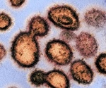 Hydroxychloroquine ineffective in animal SARS-CoV-2 infection