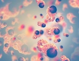 Challenges in High Complexity Flow Cytometry