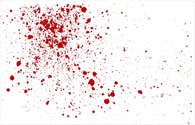 What Is Bloodstain Pattern Forensic Analysis 