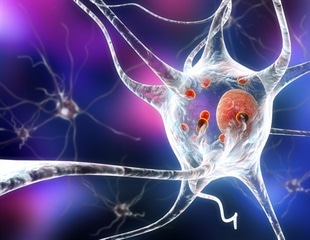 Parkinson's disease diagnosed after SARS-CoV-2