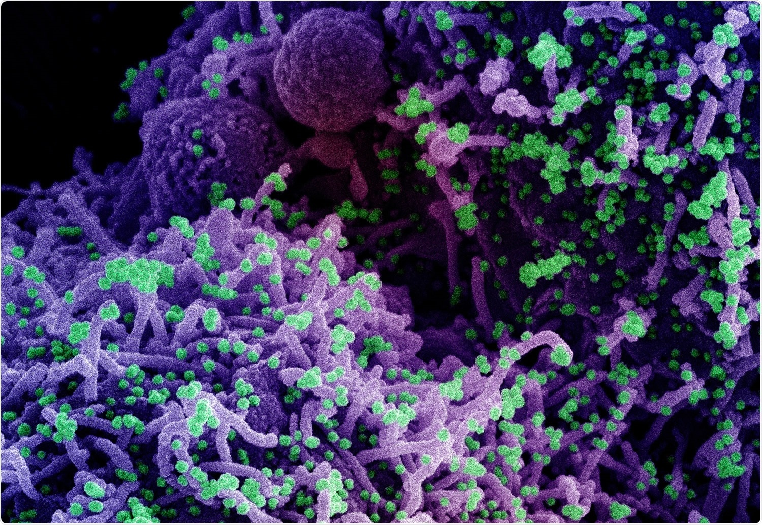 Study: The spike protein of SARS-CoV-2 variant A.30 is heavily mutated and evades vaccine-induced antibodies with high efficiency. Image Credit: NIAID