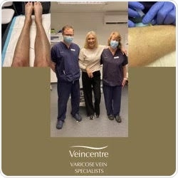 TV celebrity Angie Best checks in to Oxford Veincentre – News-Medical.net