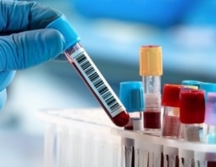 How the new In-Vitro Diagnostics Regulations are affecting the life sciences landscape