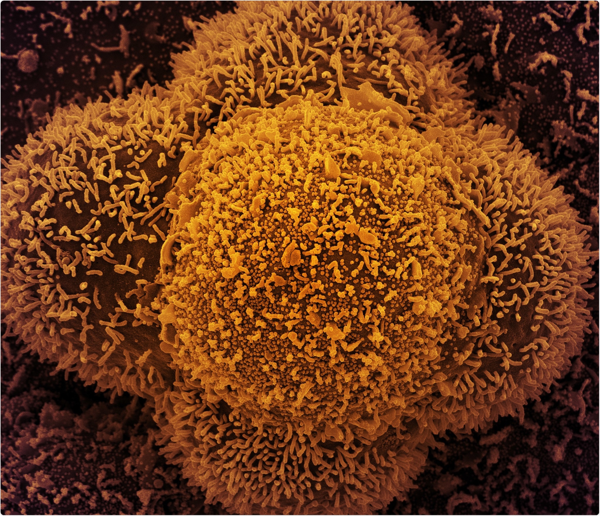 Study: Linear epitope landscape of the SARS-CoV-2 Spike protein constructed from 1,051 COVID-19 patients. Image Credit: NIAID