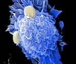 Review helps understand the mechanisms of R-CHOP resistance in diffuse large B-cell lymphoma
