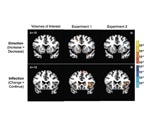Forecasting changes in stock prices based on brain activity