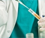 Thousands of men to trial new home test kit for prostate cancer