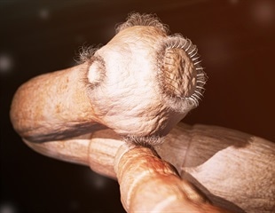 Tapeworm infection drug blocks SARS-CoV-2 damage in the lungs