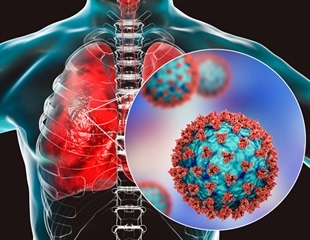 How SARS-CoV-2 infection progresses throughout the respiratory system