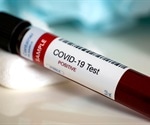 Durability of immunity to SARS-CoV-2 reinfection among initially unvaccinated individuals with previous SARS-CoV-2 infection