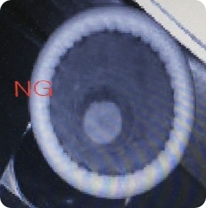 Condom Inspection NG