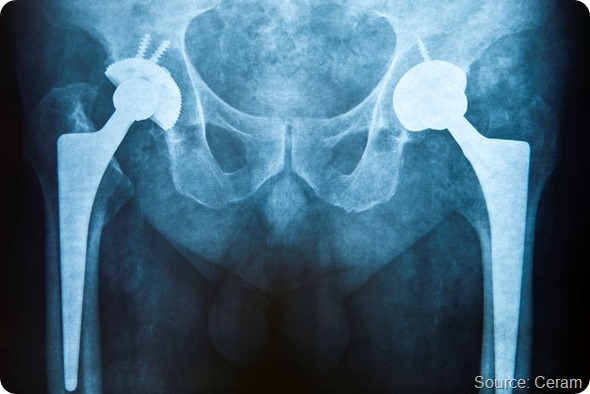 iStock_000017097678XLarge - x-ray - resized