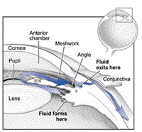 Glaucoma Management