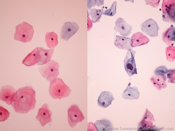 What is cytopathology?
