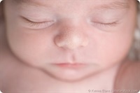 Milia Dans Les Bebes