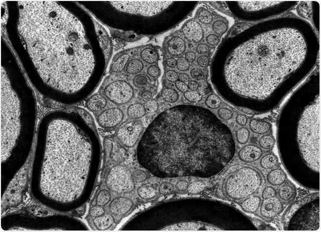 Limitations of TEM