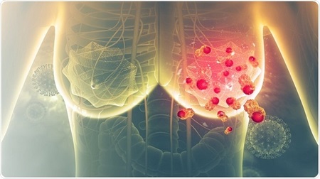 New 3D model shows how breast cancer cells interact with the body’s ...