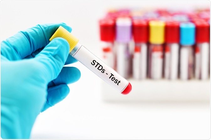 What is an STD?