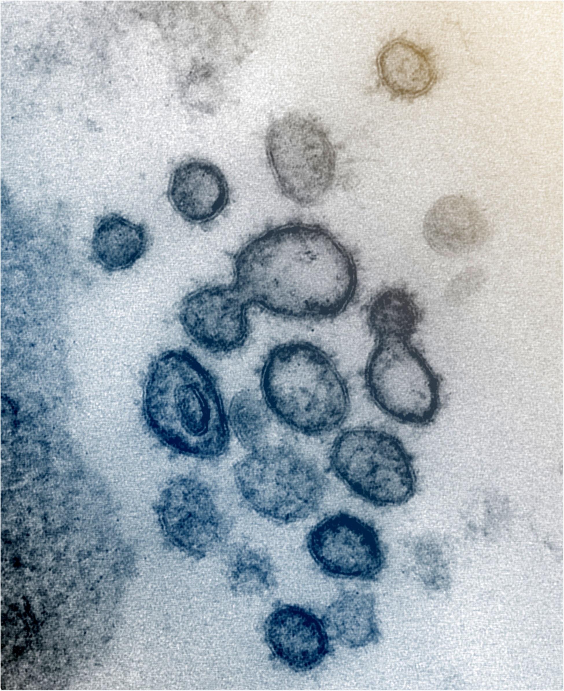 Favipiravir has weak effect on SARS-CoV-2 and Hydroxychloroquine none ...