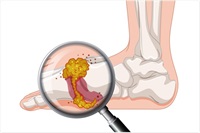 is tirzepatide good for menopause Weight Loss Injections and Menopause: A Specialist Guide to HRT  Compatibility (2026)