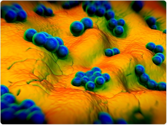 What are Superbugs?