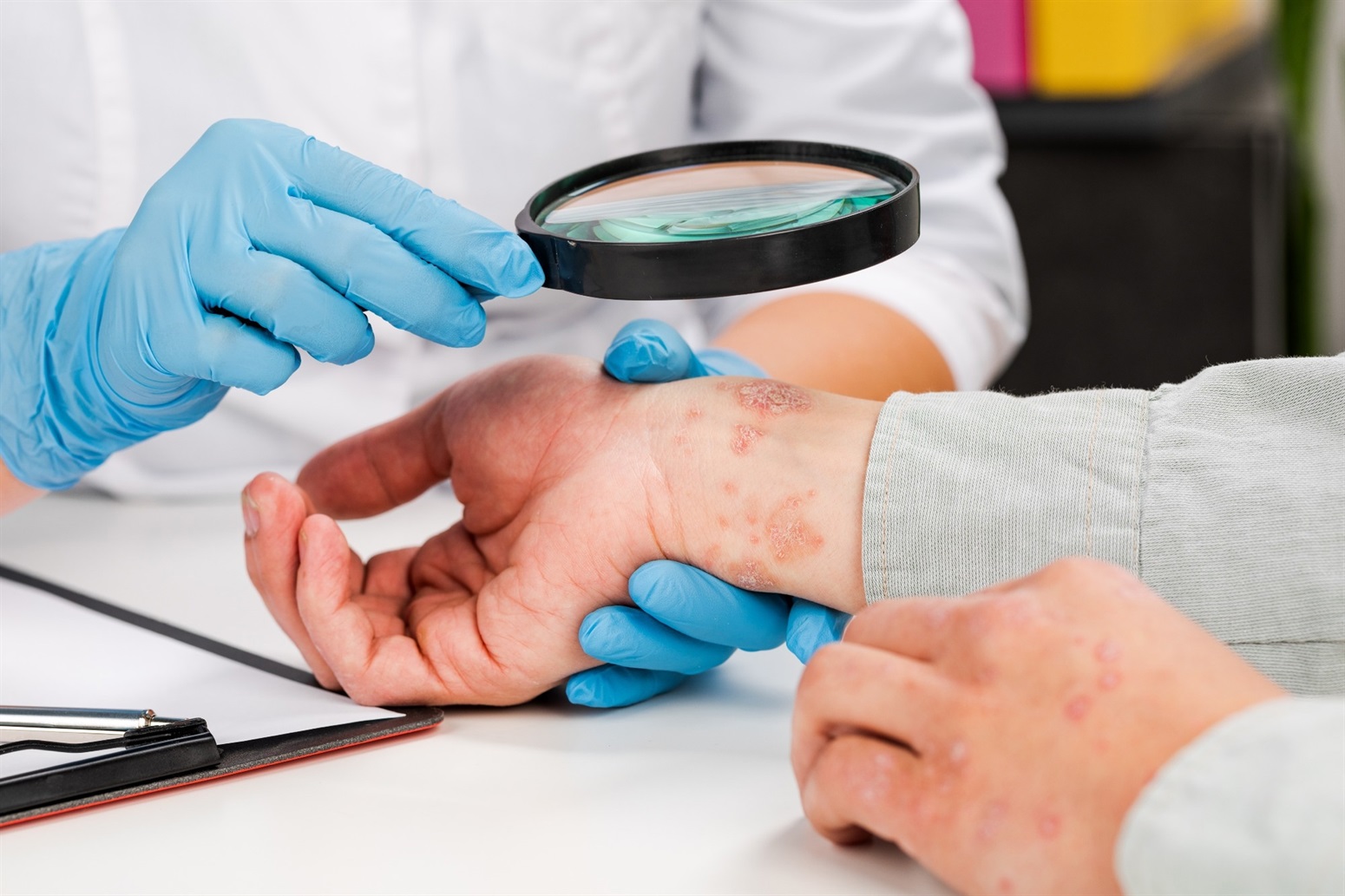 Pee Rash What is Incontinence-Associated Dermatitis?