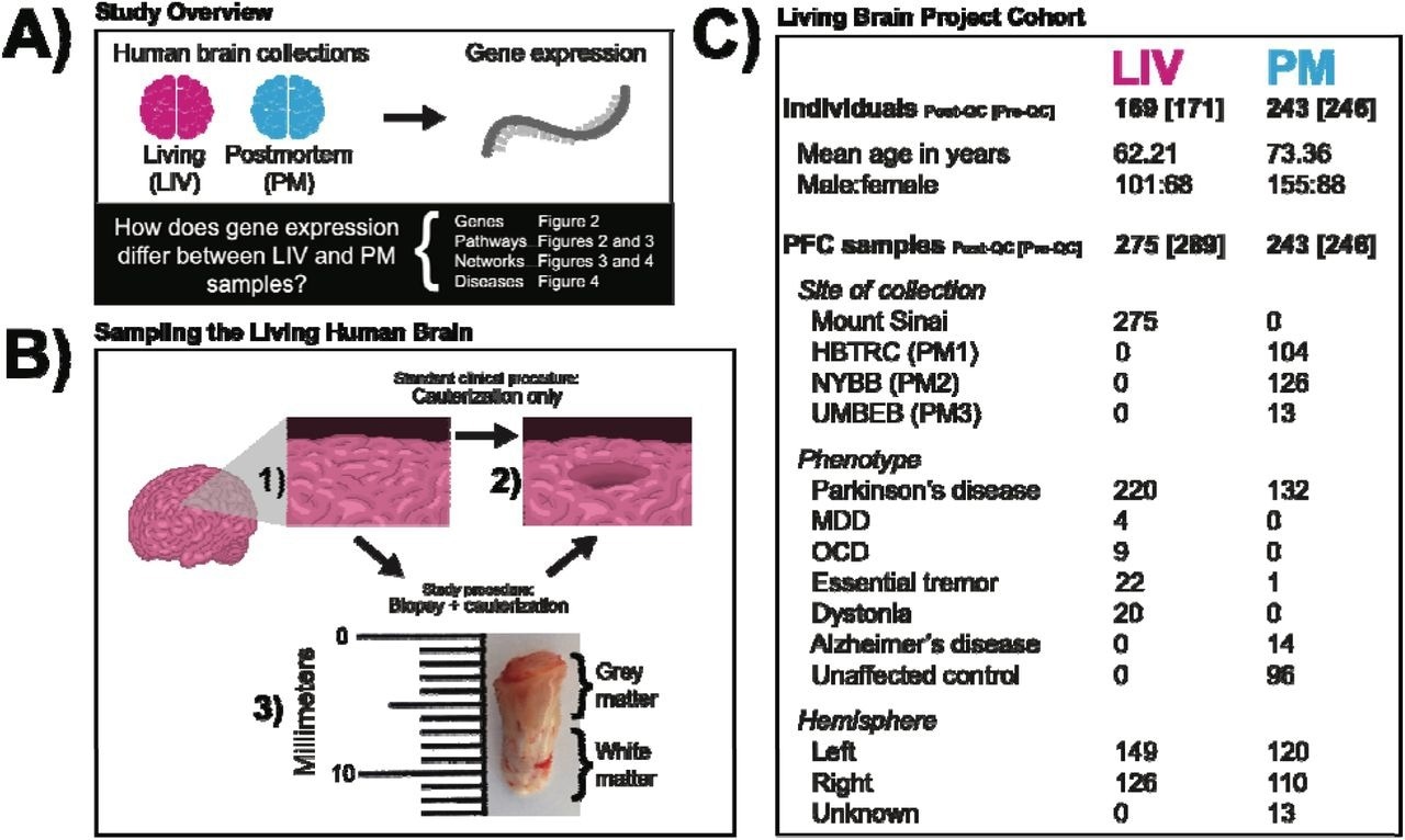 Similarities in gene expression between post-mortem and living human brains