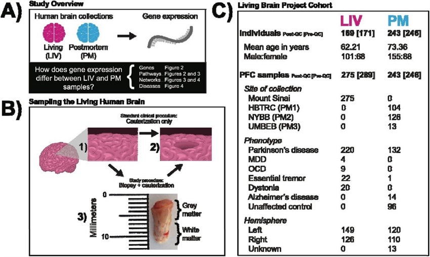 Similarities in gene expression between post-mortem and living human brains