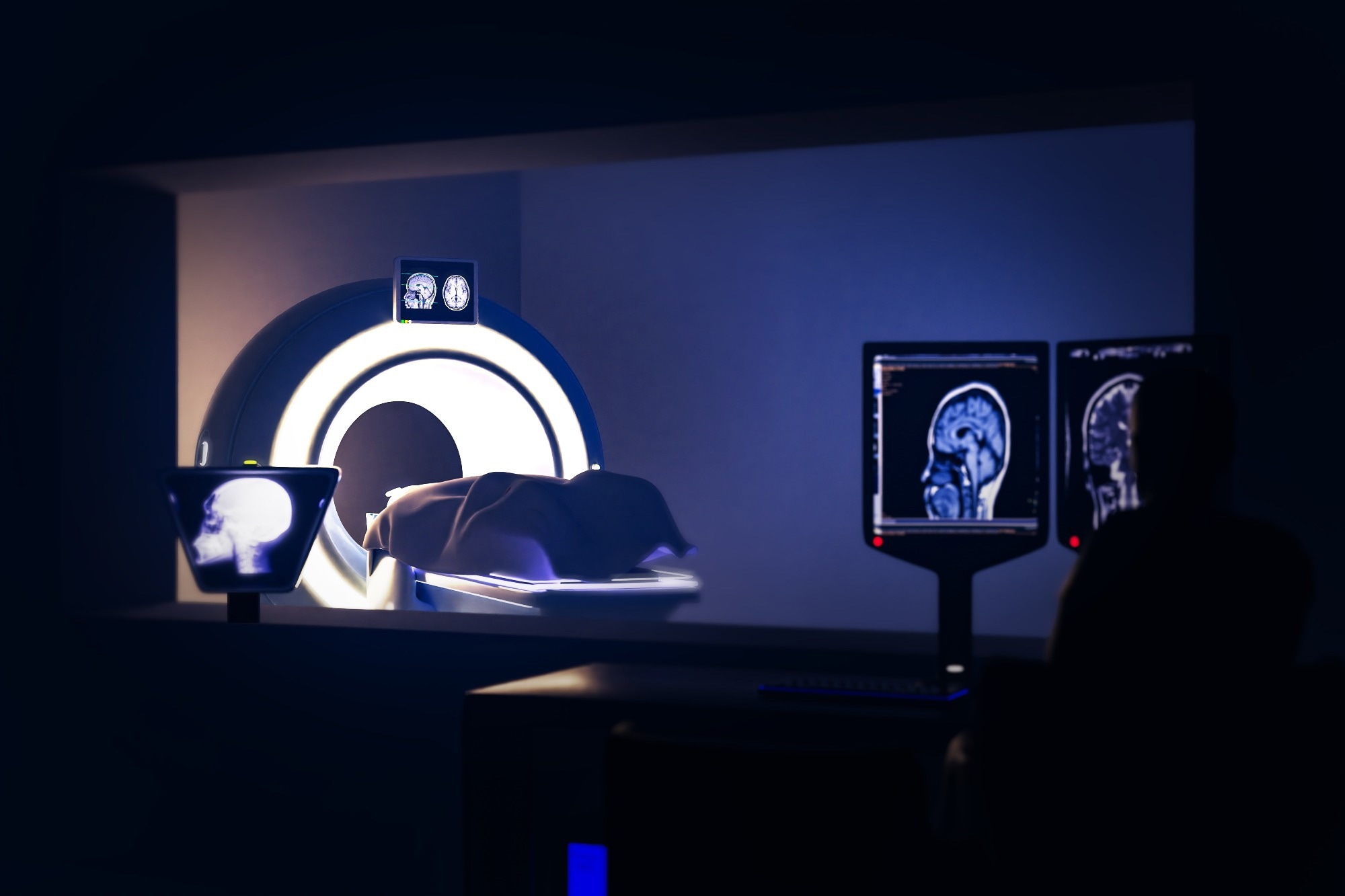Study reveals CT scan overuse could account for 1 in 20 new US cancers