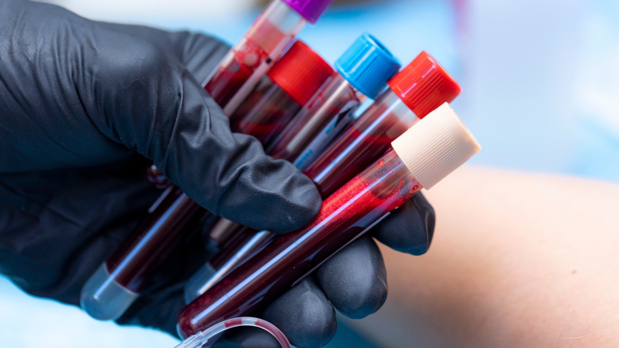 Human Lab Test Essential Baseline Lab Tests for Preventive Health Assessment