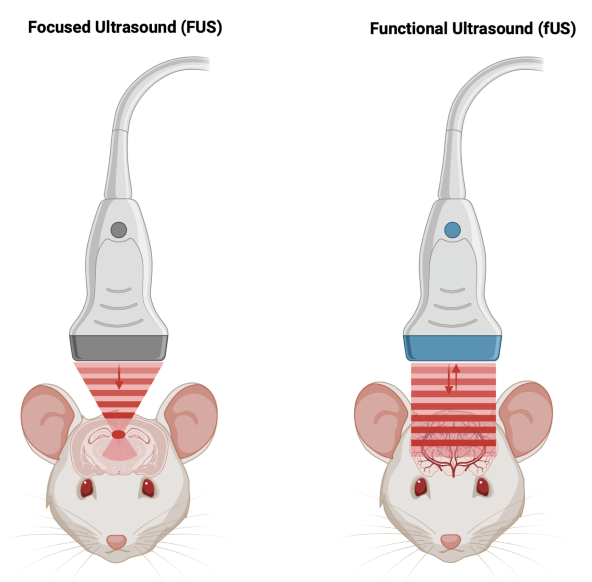 Functional ultrasound vs. focused ultrasound