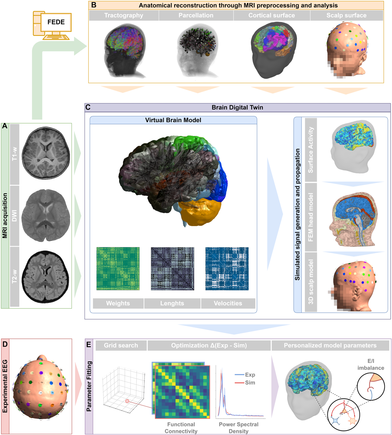 Digital brain twin recreates brain activity in a toddler with autism